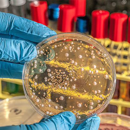 Pengendalian Kesehatan dan Penyakit